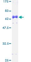 Human DLX3 Protein (Recombinant GST)