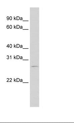 RBM38 Antibody (aa41-90)
