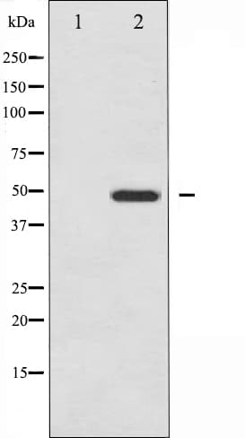 Vitamin D Receptor / VDR Antibody