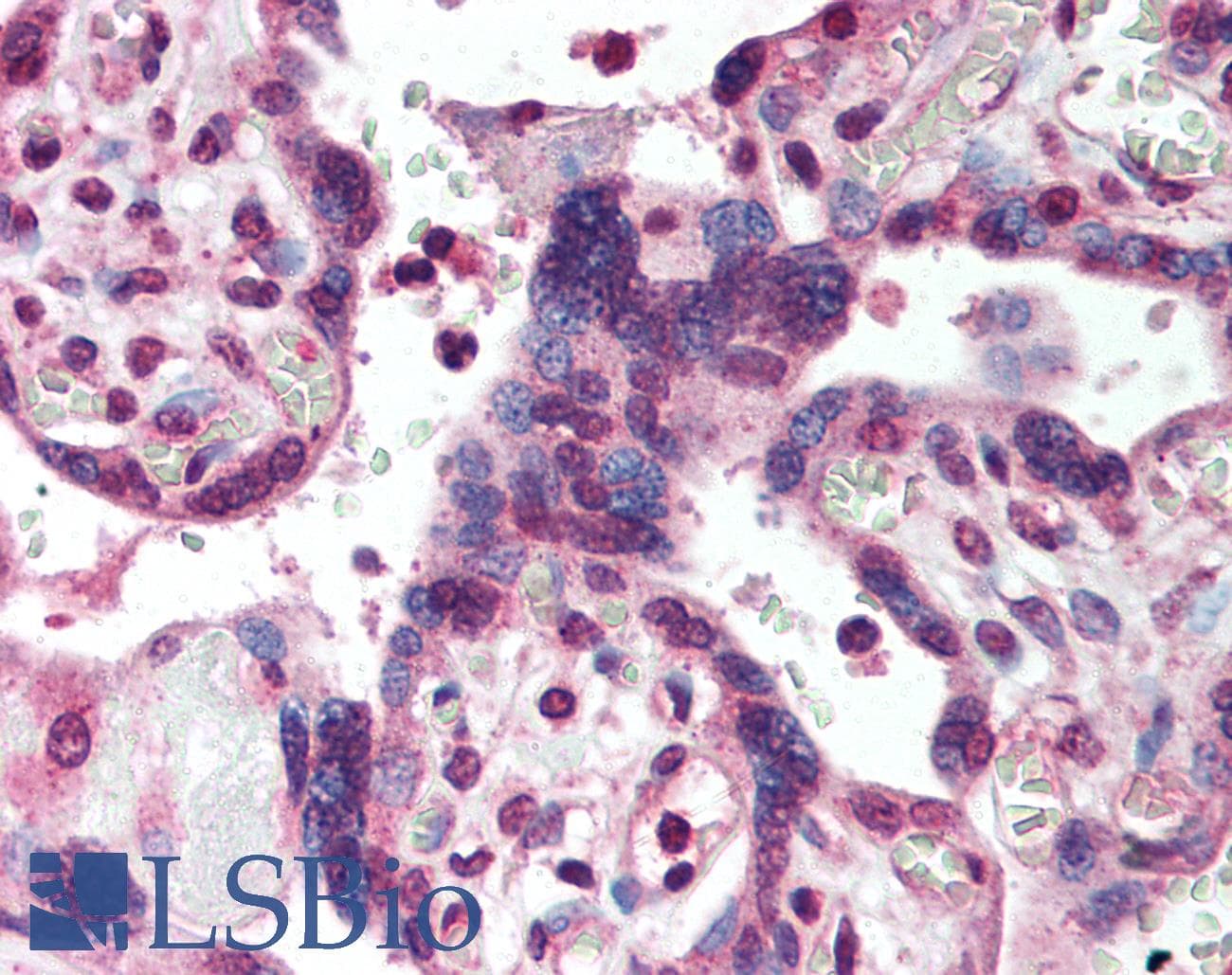 IHC-plus™ Polyclonal Rabbit anti-Human SMAD2 Antibody (aa234-249, IHC, WB)