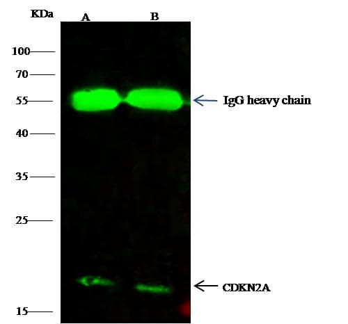 p16INK4a / CDKN2A Antibody (Preservative Free)