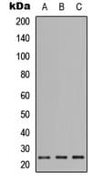 IHC-plus™ PIGF Antibody (C-Terminus)