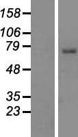 Human TIRC7 / TCIRG1 Protein (Over-Expression Lysate Myc-DDK (Flag))