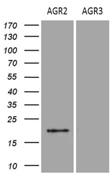 AGR2 Antibody (aa21-175, clone OTI1H8)