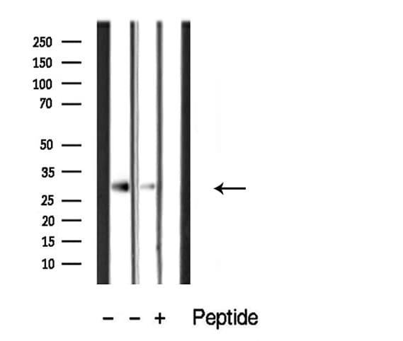 CTDSP1 / SCP1 Antibody