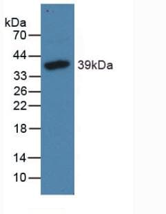 NPPB / BNP Antibody (Biotin)