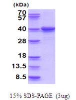 Human LZTFL1 Protein (Recombinant His)