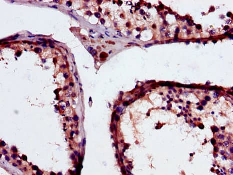 GSTM3 Antibody