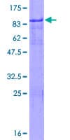 Human IKZF2 / HELIOS Protein (Recombinant GST)
