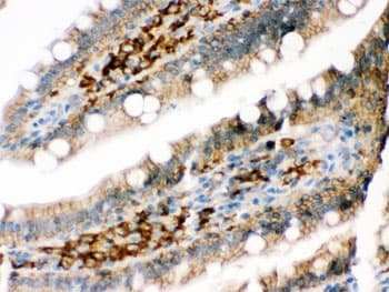 Polyclonal Rabbit anti-Human PPP1R1B / DARPP-32 Antibody (IHC, WB)