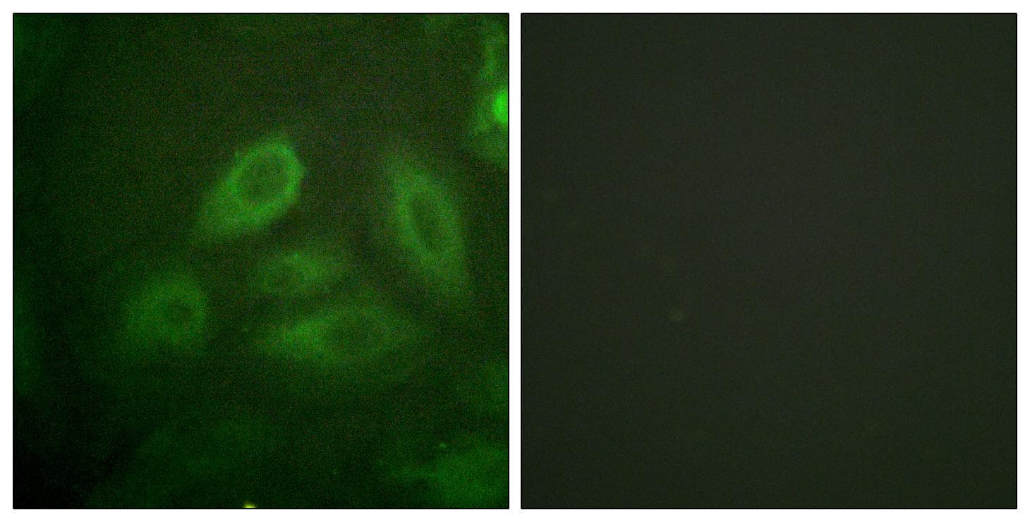 DPYSL2 / CRMP2 Antibody (phospho-Thr514)