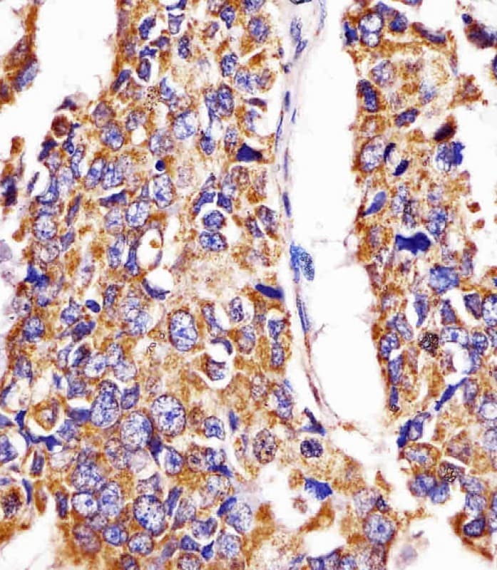 HSPD1 / HSP60 Antibody