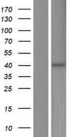 ST3GAL5 / GM3 Synthase Protein (Over-Expression Lysate Myc-DDK (Flag))
