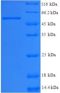 Human WDR5 Protein (Recombinant His-SUMO)