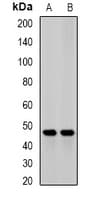 JMJD6 / PSR Antibody