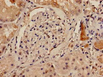 DLG1 / SAP97 Antibody