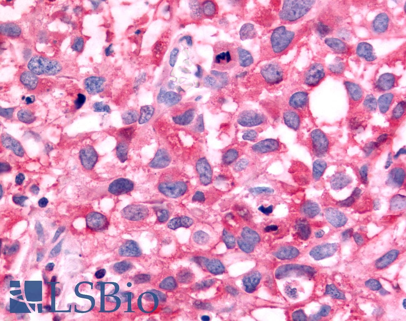 PathPlus™ NR5A2 / LRH-1 Antibody (C-Terminus)