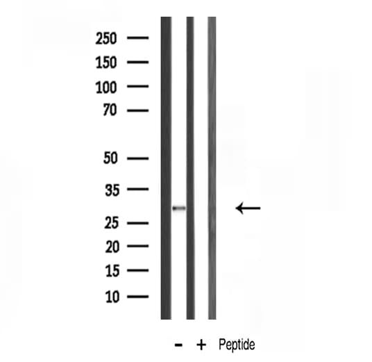 Polyclonal Rabbit anti-Human RPS4X Antibody (IF, WB)