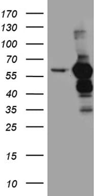 TRXR1 / TXNRD1 Antibody (clone OTI7B2, Carrier-free)