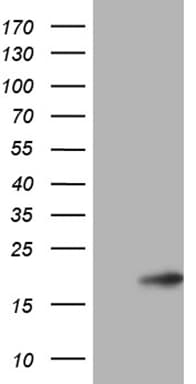 p16INK4a / CDKN2A Antibody (clone OTI11D3)