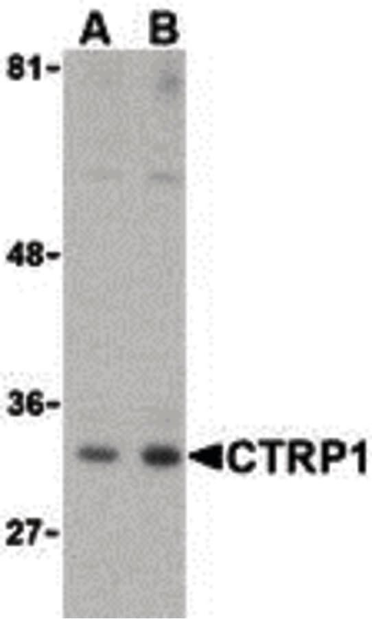 C1QTNF1 / CTRP1 Antibody