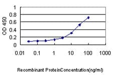 KHK / Ketohexokinase Antibody (clone 1H6-2B6)