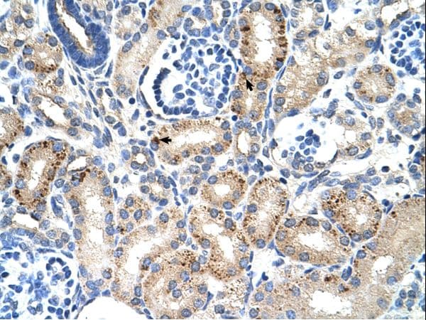 Polyclonal Rabbit anti-Human EMA / MUC1 Antibody (C-Terminus, IHC, WB)