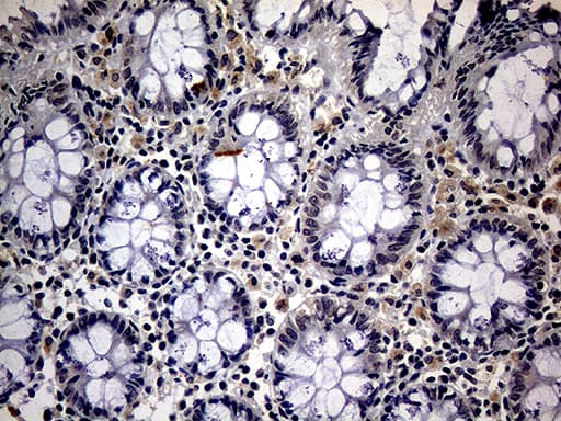 ITGB1 / Integrin Beta 1 / CD29 Antibody (clone OTI9B5)