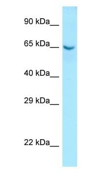 Polyclonal Rabbit anti-Human COL9A1 / Collagen IX Antibody (aa80-129, WB)