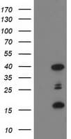 PDLIM2 / SLIM Antibody (clone OTI1D12)