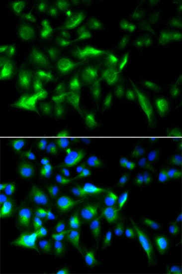 MYD88 Antibody