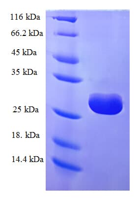 Human TRMT112 Protein (Recombinant His-SUMO)