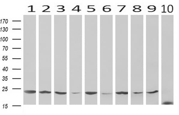 VBP1 Antibody (clone UMAB75)