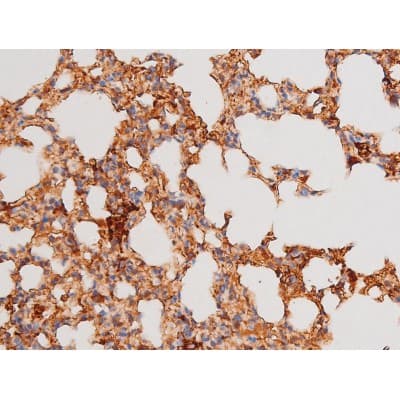 FOXO4 / AFX1 Antibody (phospho-Ser197)