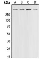 IHC-plus™ CREBBP / CREB Binding Protein Antibody (C-Terminus)