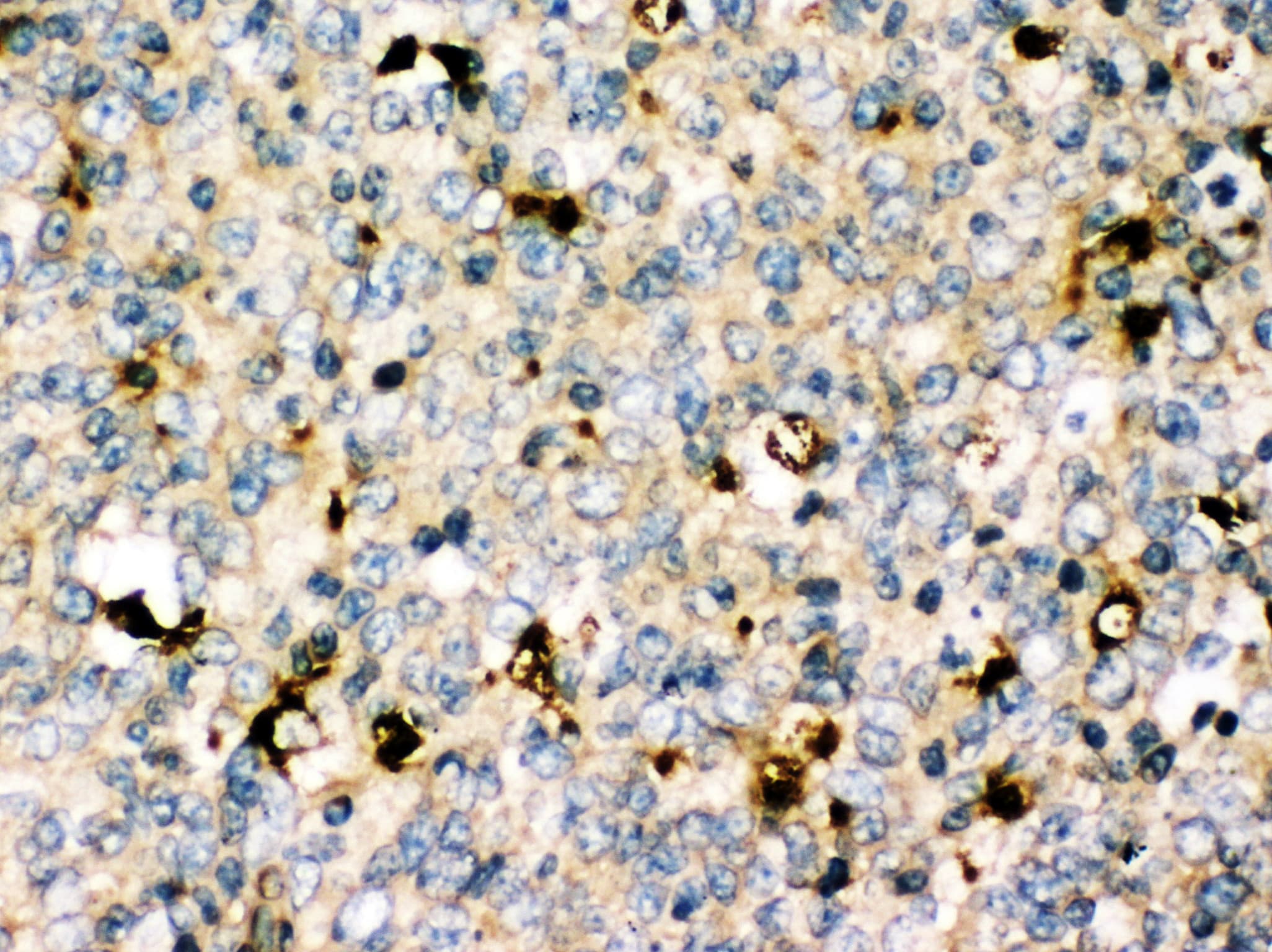 Polyclonal Rabbit anti-Human MYD88 Antibody (aa174-188, IHC, WB)