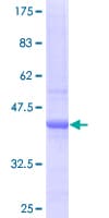 Human SULF2 / Sulfatase 2 Protein (Recombinant GST)