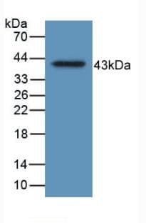 HFE2 / Hemojuvelin Antibody (APC)