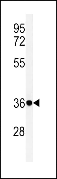 FCGR1A / CD64 Antibody (aa217-245)
