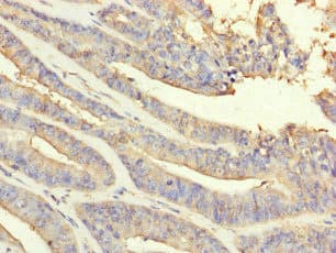 PRDX2 / Peroxiredoxin 2 Antibody
