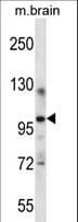 ITCH / AIP4 Antibody (aa509-536)