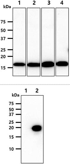 NME2 Antibody (clone AT2E3)