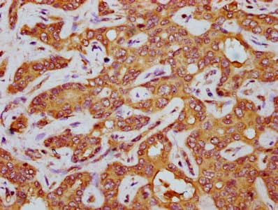 AGT / Angiotensinogen Antibody