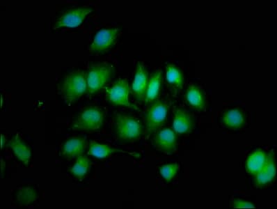 Polyclonal Rabbit anti-Human PTPN3 Antibody (IHC, IF)