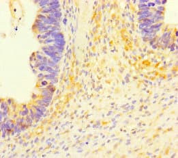 Polyclonal Rabbit anti-Human SLC35D2 Antibody