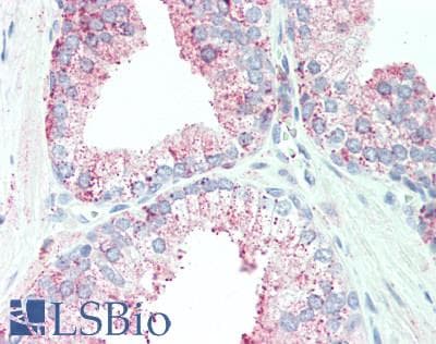 Polyclonal Rabbit anti-Mouse TNFAIP6 / TSG-6 Antibody (aa18-275, IHC, WB)