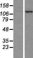 PKN2 Protein (Over-Expression Lysate Myc-DDK (Flag))