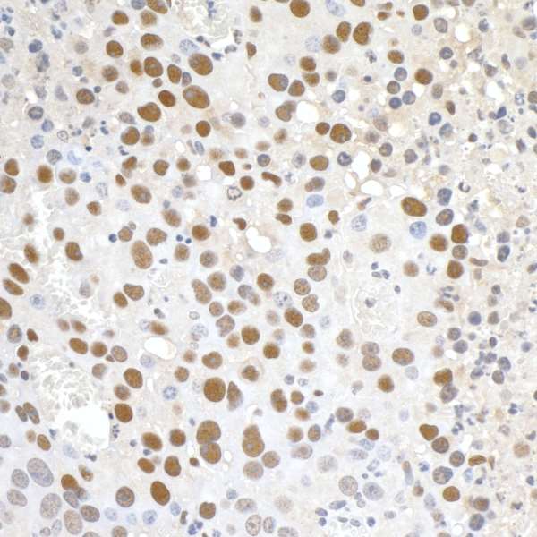 Polyclonal Rabbit anti-Human PD2 / PAF1 Antibody (aa475-525, IHC)