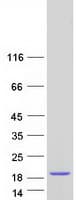 Human KHDC1L Protein (Recombinant Myc-DDK (Flag))