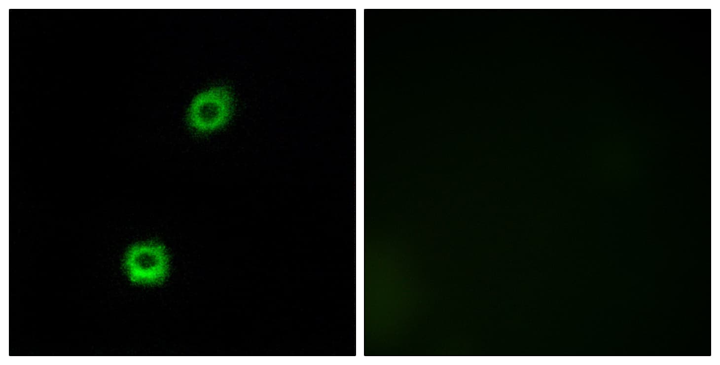 MARCKS Antibody (aa126-175)